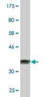 Anti-ALDH9A1 Antibody