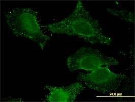 Anti-ALDH9A1 Antibody
