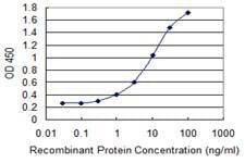 Anti-ALDH9A1 Antibody
