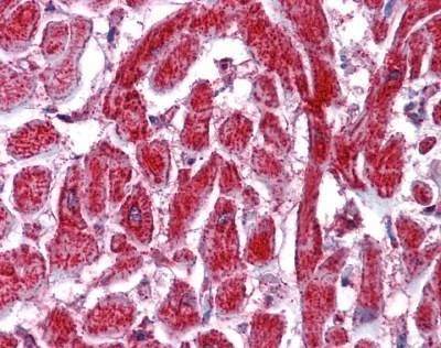 Anti-PDIA2 (Internal) Antibody