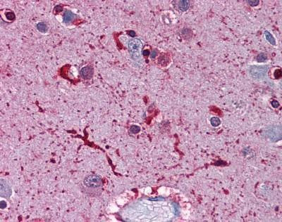 Anti-FTL / Ferritin Light Chain (C-term) Antibody