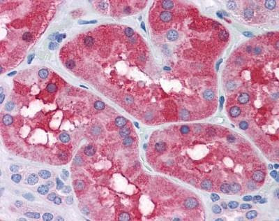 Anti-FTL / Ferritin Light Chain (C-term) Antibody
