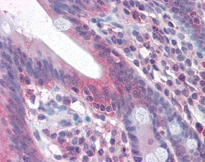 Anti-CD95 / FAS (Internal) Antibody