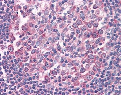 Anti-CD95 / FAS (Internal) Antibody