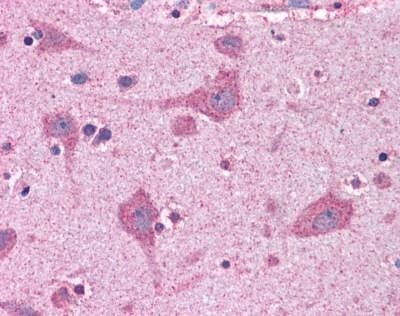 Anti-ACSL4 (C-term) Antibody