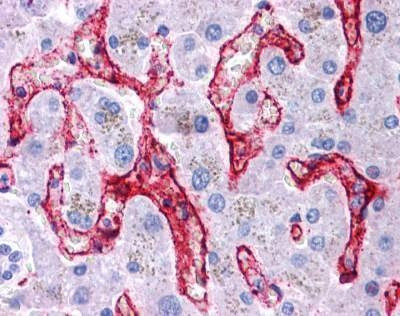 Anti-FCGR2B / CD32 (C-term) Antibody