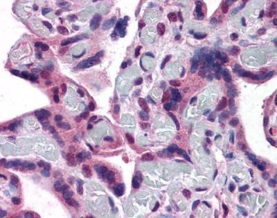 Anti-TRPC4 (C-term) Antibody