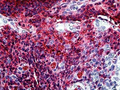 Anti-TGF-Beta Antibody