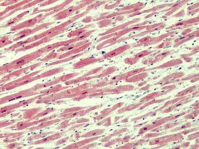 Anti-IRAK4 (N-term) Antibody