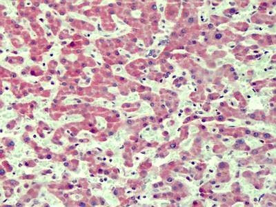 Anti-IRAK4 (N-term) Antibody