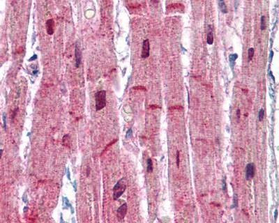 Anti-ACTN2 Antibody