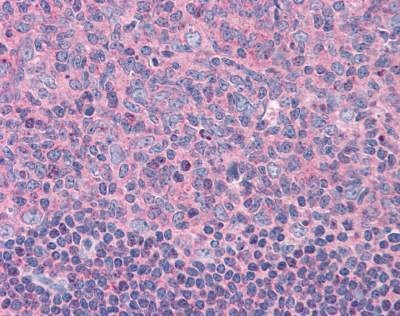 Anti-ELP3 Antibody
