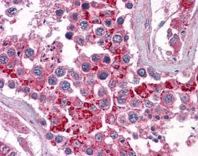 Anti-BIRC3 / cIAP2 Antibody