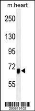Anti-Mouse ACVR1B Antibody