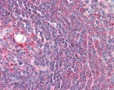 Anti-CYP26B1 (Internal) Antibody