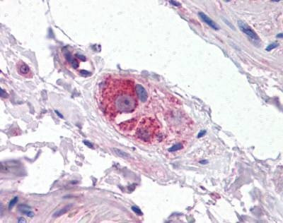 Anti-CYP26B1 (Internal) Antibody