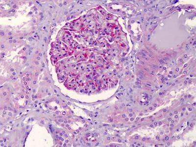 Anti-NALP3 / NLRP3 Antibody