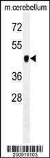 Anti-PDK2 Antibody