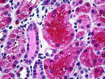 Anti-KCNN4 / KCa3.1 (aa227-239) Antibody