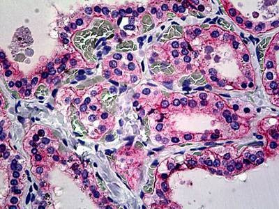 Anti-Integrin Alpha V / CD51 (C-term) Antibody
