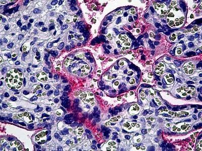Anti-Integrin Alpha V / CD51 (C-term) Antibody