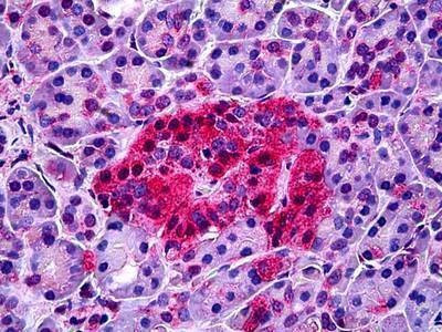 Anti-NTSR1 / NTR (Internal) Antibody