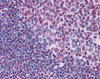 Anti-MYB / c-Myb (N-term) Antibody