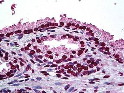 Anti-DLX2 Antibody
