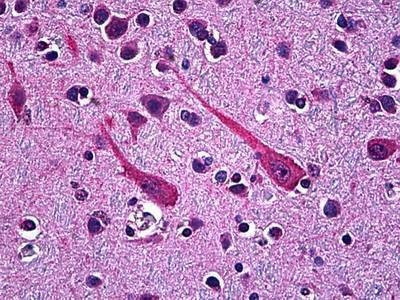 Anti-PCSK1 / PC1 Antibody