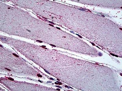 Anti-GAX / MEOX2 Antibody