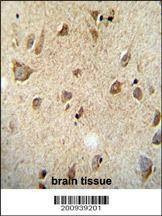 Anti-RET (Ascites) Antibody