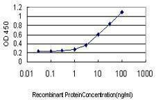 Anti-ALDOB Antibody