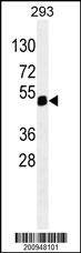 Anti-PAX6 (Ascites) Antibody