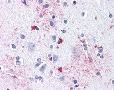 Anti-SLC29A1 / ENT1 (Internal) Antibody