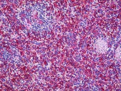 Anti-MMP11 (Internal) Antibody