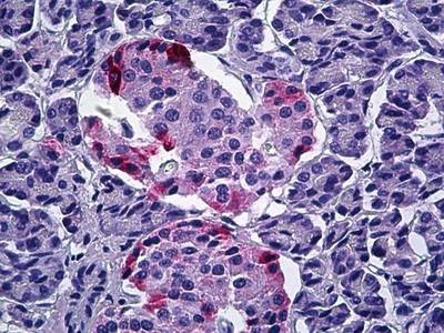 Anti-Pancreatic Hormone (Internal) Antibody