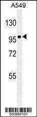 Anti-ZEB1 ( Ascites) Antibody