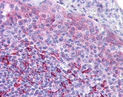 Anti-GPR171 (Extracellular Domain) Antibody