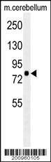 Anti-RPS6KA1 Antibody