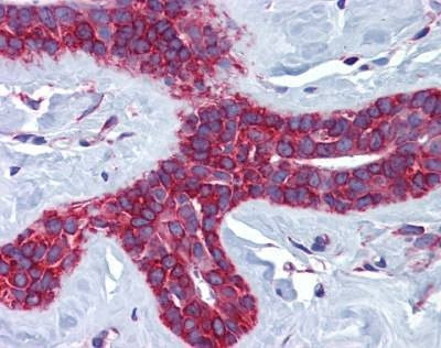 Anti-CTSL2 / Cathepsin V (Internal) Antibody