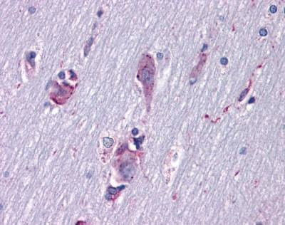 Anti-ISLET-1 / ISL1 Antibody