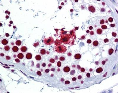 Anti-SRSF3 / SRP20 (C-term) Antibody