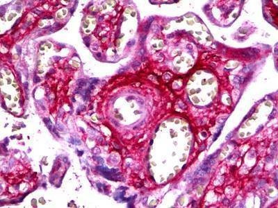 Anti-CCA / Fibrillin 2 Antibody