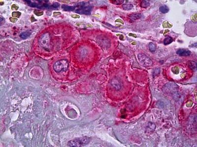 Anti-SERPINE1 / PAI-1 Antibody