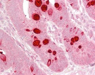 Anti-EIF2C / AGO1 (Internal) Antibody