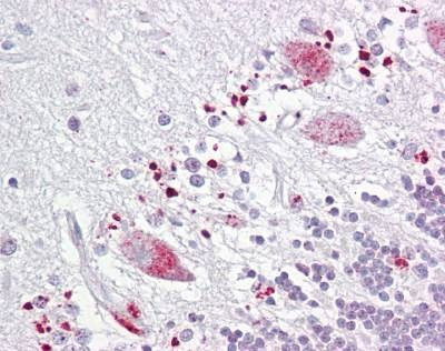 Anti-TIGAR (aa140-190) Antibody