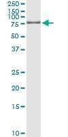 Anti-ALF Antibody