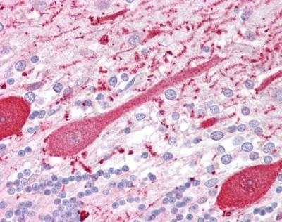 Anti-RET (C-term) Antibody