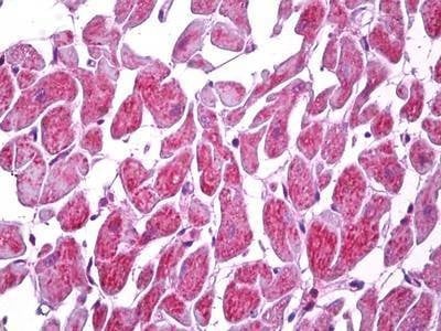Anti-PAR-1 / MARK2 (Internal) Antibody