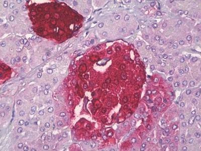 Anti-Somatostatin (N-term) Antibody